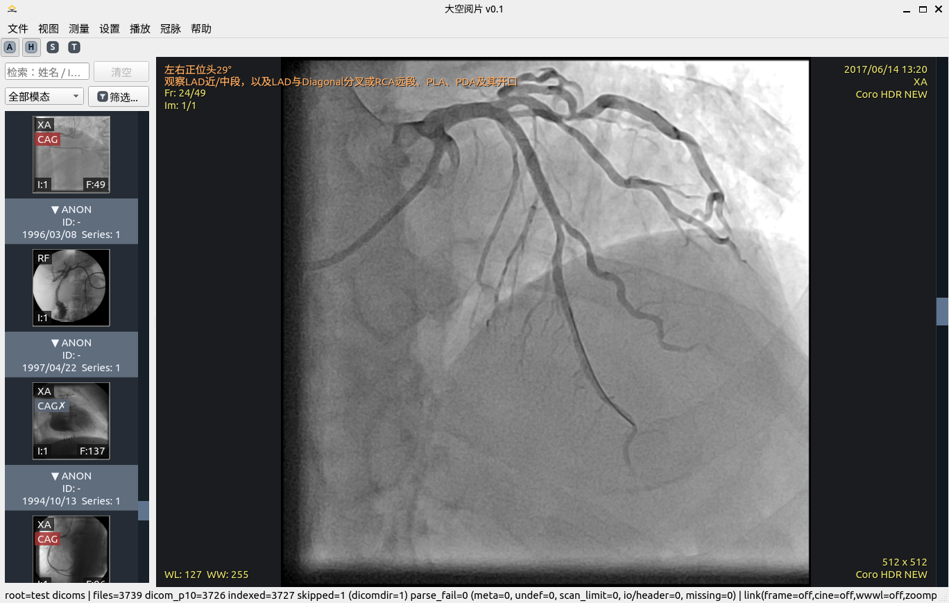 大空阅片软件截图