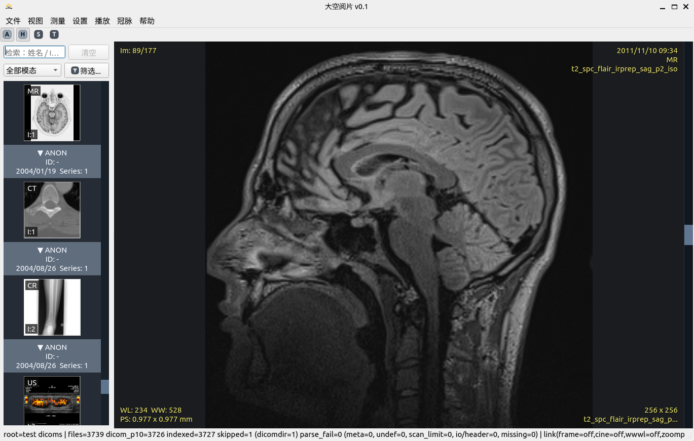 DICOM 稳定全面解析