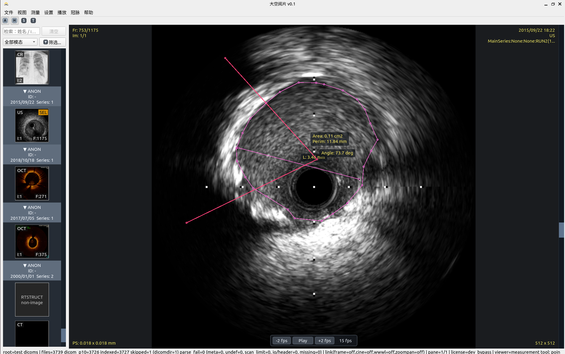 测量工具与管理
